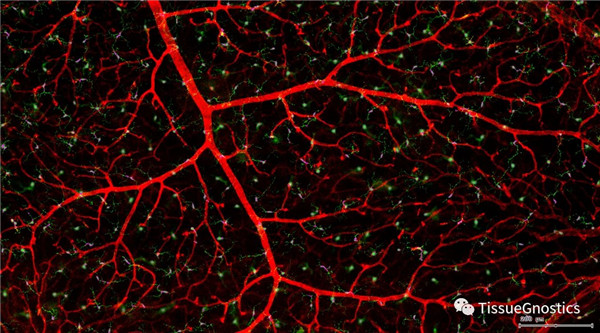 TissueGnostics带您解读视网膜组织形态学特征及多种结构定量-江西省立康科技有限公司