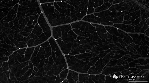 TissueGnostics带您解读视网膜组织形态学特征及多种结构定量-江西省立康科技有限公司